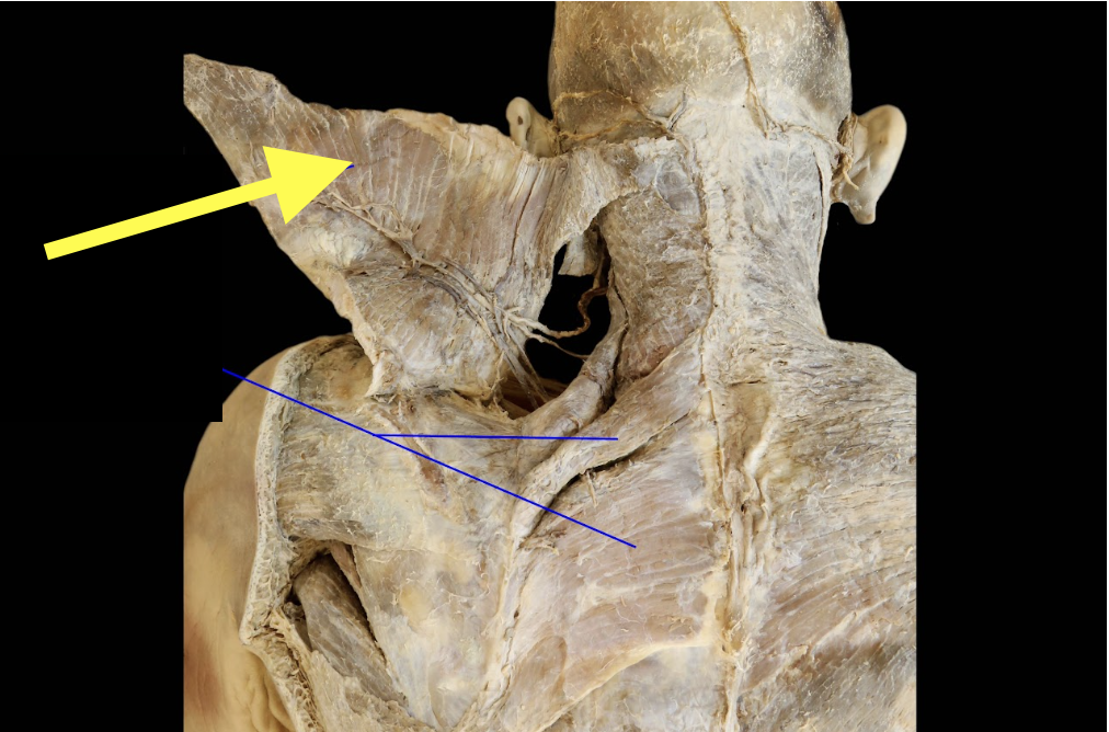 <p>Identify the reflected muscle </p>