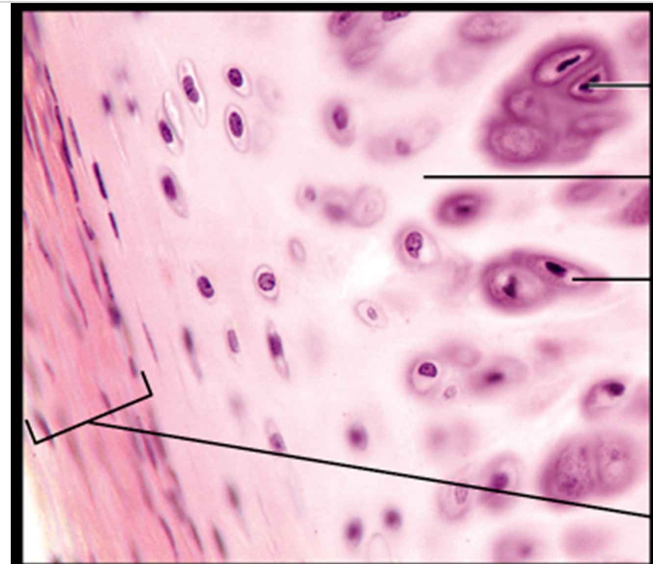 <p>Looks like frosted glass</p><p><span style="background-color: transparent;">It makes up the articular cartilage that covers the ends of adjoining bones in movable joints.</span></p><p><span style="background-color: transparent;"> It also forms the cartilaginous attachments of the ribs to the sternum, accounts for most of the cartilage found in the respiratory structures, and forms the embryonic skeleton</span></p>