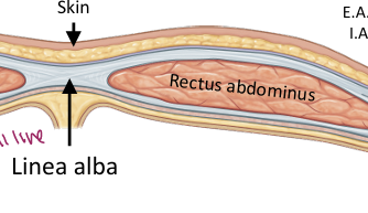 <p>Fibrous midline raphe formed by fusion of the abdominal muscle aponeuroses (2 pack) </p>