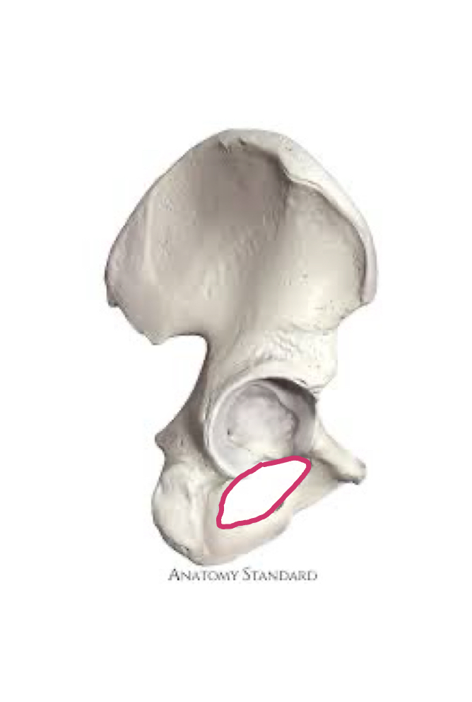 <p>Hole in hip bone </p>