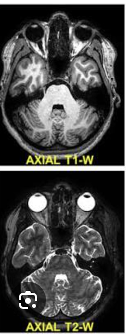 <p>From the feet toward the head like CT</p>