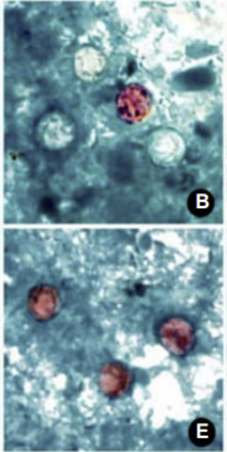 <p>-Oocysts 8-10 um (slightly larger than RBC)</p>