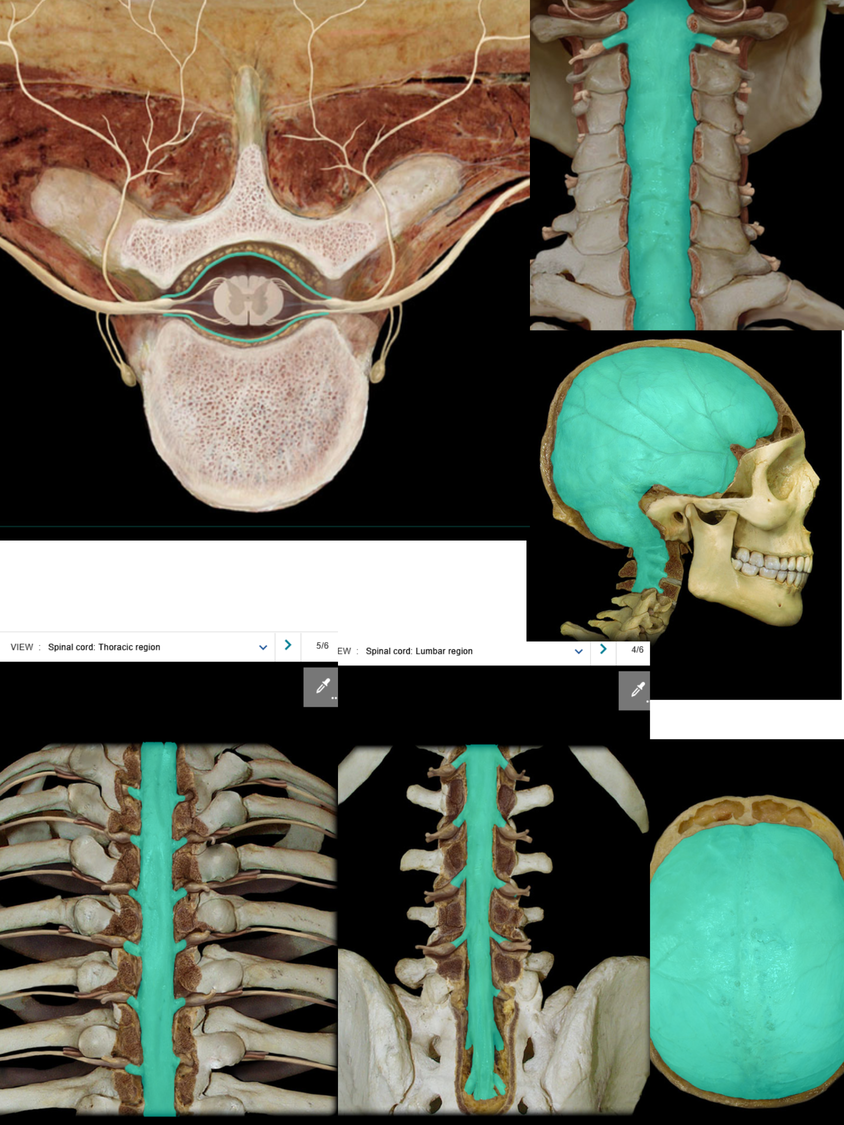 <p>Dura mater</p>
