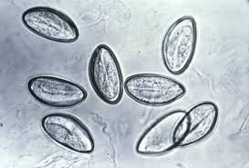 <p>Pinworm-most common nematode infection in U.S.</p>
