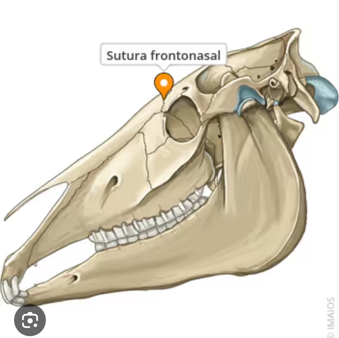 <p>sutura frontonasal</p>