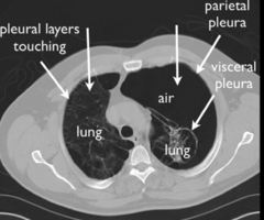<p>identify the pathology:</p>