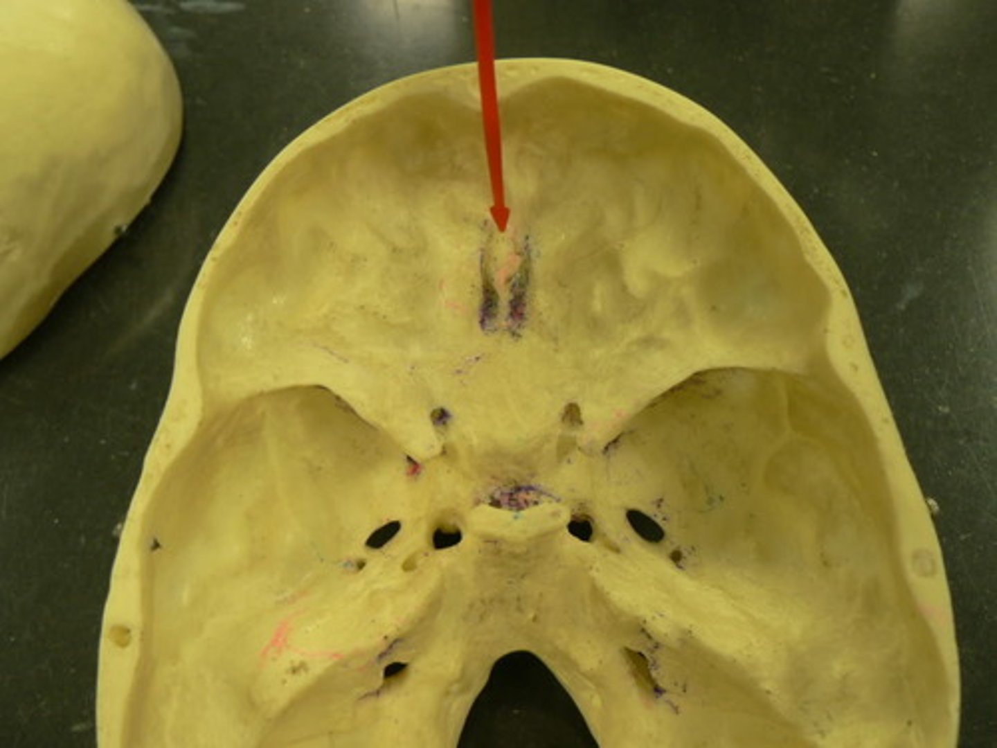 <p>Id structure at arrow</p>
