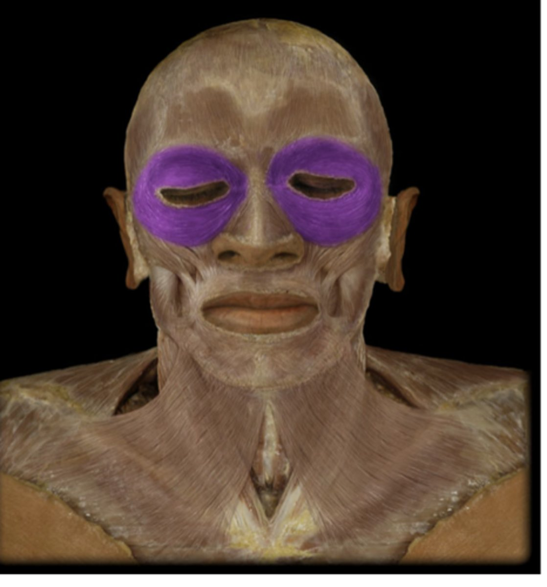 <p>What muscle is indicated in purple?,</p>