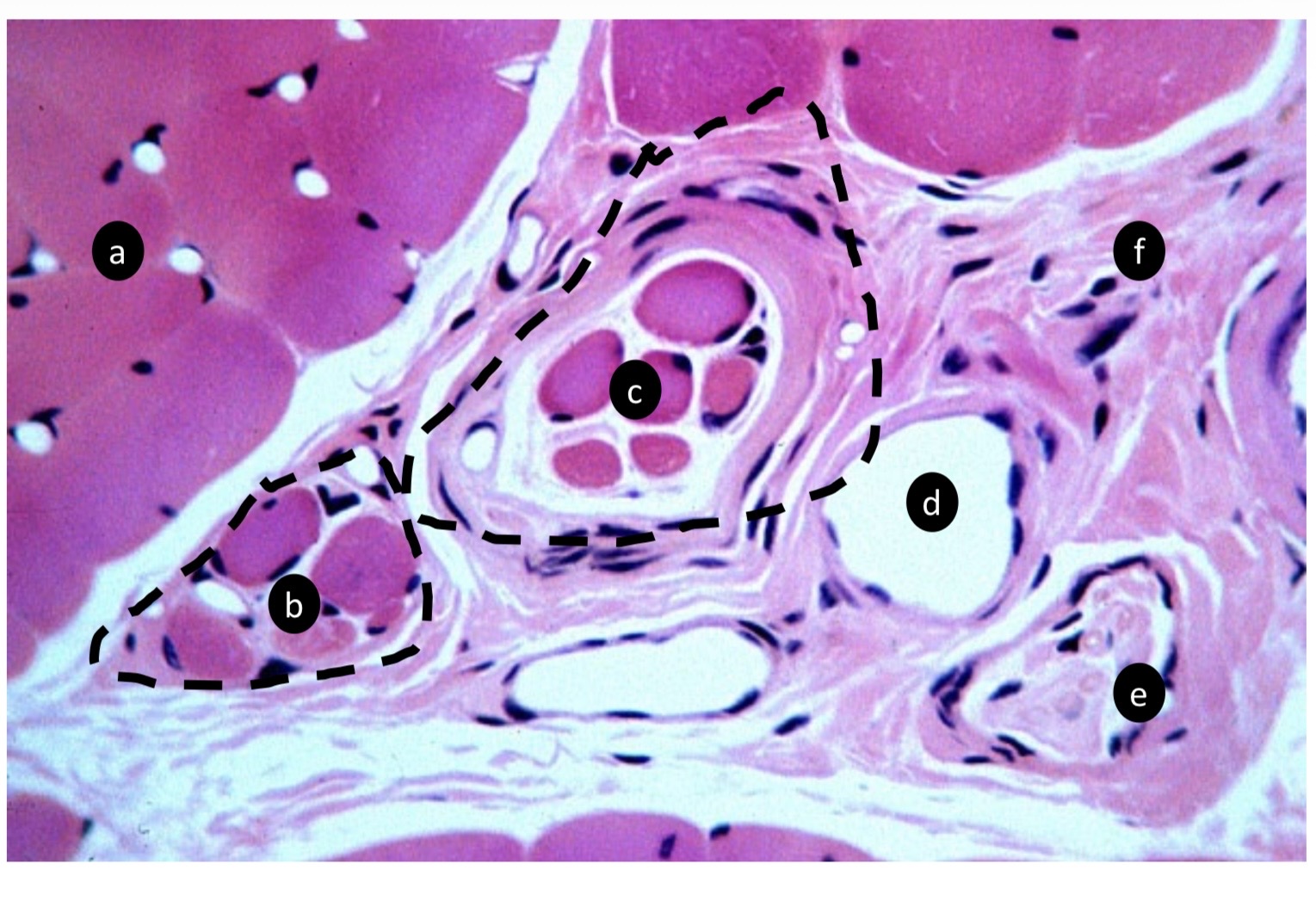 <p>Label the image. </p><p>A. ID the specific tissue type </p><p>B. ID the specific tissue type </p><p>C. ID the specific tissue type </p><p>D. What is the function of the structure in ( c ) above? </p><p>E. ID the specific structure </p><p>F. ID the specific structure </p><p>G. ID the type of tissue </p>
