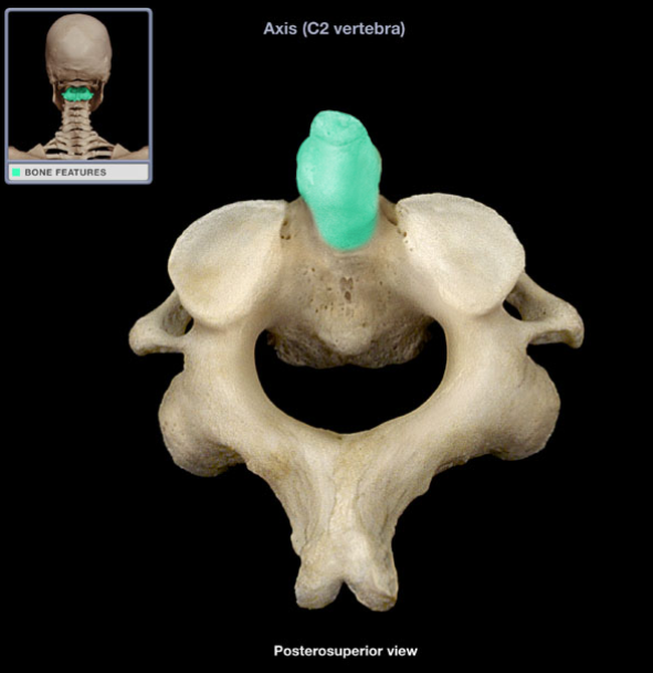 <p>What is the name of this structure?</p>