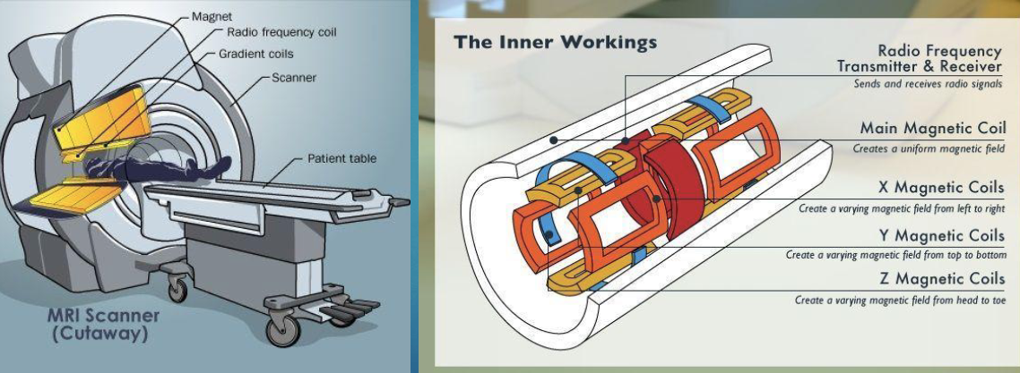 <p>metallic items</p><p>medical equipment</p><p>implanted items in patients</p><p>nephrogenic systemic sclerosis</p>