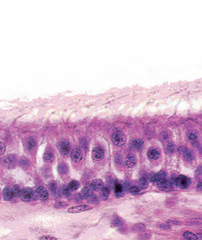 <p>what is this in histology?</p>