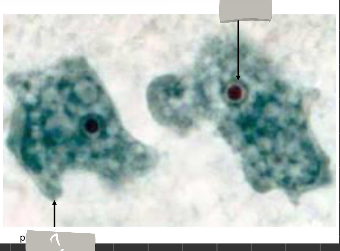 term image