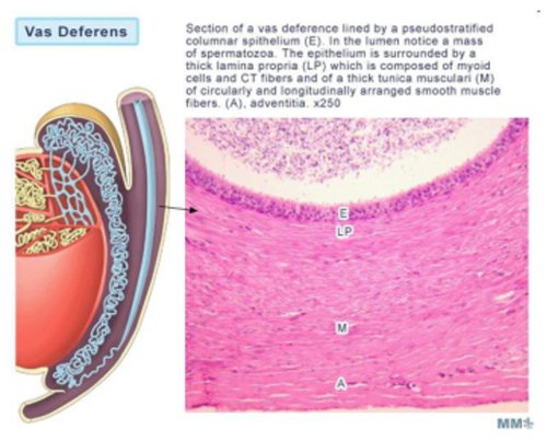 <p>Low cuboidal epithelium and thick smooth muscle tube which contracts to move sperm along narrow lumen and strong peristaltic contractions propel them during ejaculation</p><p>Stores sperm </p><p></p>