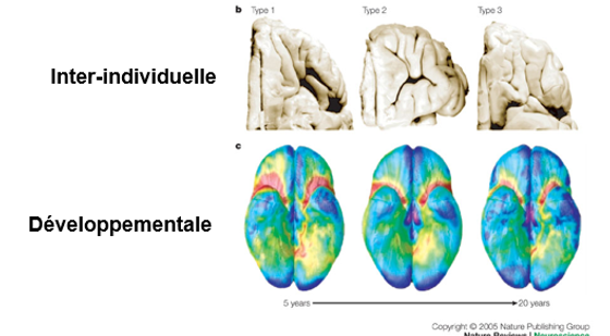 <p><span style="line-height: 107%;">·</span><span style="font-family: "Times New Roman", serif; line-height: 107%;">Grande variabilité dans son organisation inter-individuelle et développementale</span></p><p></p><p class="MsoListParagraph"><span style="line-height: 107%;">·</span><span style="font-family: "Times New Roman", serif; line-height: 107%;">Au niveau phylogénétique (évolution du cerveau)&nbsp;: fonctions frontales sont celles qui se sont le plus développées (et en dernier) dans l’évolution</span></p><p class="MsoListParagraph"></p><p class="MsoListParagraph"><span style="line-height: 107%;">·</span><span style="font-family: "Times New Roman", serif; line-height: 107%;">Variabilité inter-individuelle</span></p><p class="MsoListParagraph"><span style="font-family: "Courier New"; line-height: 107%;">o</span><span style="font-family: "Times New Roman"; line-height: normal; font-size: 7pt;">&nbsp;&nbsp; </span><span style="font-family: "Times New Roman", serif; line-height: 107%;">Régions visuelles&nbsp;: fonctions ne diffèrent pas vraiment d’un individu à l’autre, donc anatomiquement très similaire d’une personne à l’autre (comportement visuel d’un individu à l’autre reste très similaire)</span></p><p class="MsoListParagraph"><span style="font-family: "Courier New"; line-height: 107%;">o</span><span style="font-family: "Times New Roman"; line-height: normal; font-size: 7pt;">&nbsp;&nbsp; </span><span style="font-family: "Times New Roman", serif; line-height: 107%;">Orbitofrontal&nbsp;: différences anatomiques, car différences dans fonctions de hauts niveaux; Région qui se développe sur une beaucoup plus longue période</span></p><p class="MsoListParagraph"></p><p class="MsoListParagraph"><span style="line-height: 107%;">·</span><span style="font-family: "Times New Roman", serif; line-height: 107%;">Variabilités inter-individuelles (anatomiques) + développementales</span></p><p class="MsoListParagraph"></p><p class="MsoListParagraph"><span style="line-height: 107%;">·</span><span style="font-family: "Times New Roman", serif; line-height: 107%;">Développementale&nbsp;:</span></p><p class="MsoListParagraph"><span style="font-family: "Courier New"; line-height: 107%;">o</span><span style="font-family: "Times New Roman"; line-height: normal; font-size: 7pt;">&nbsp;&nbsp; </span><span style="font-family: "Times New Roman", serif; line-height: 107%;">Processus visuel&nbsp;: pas complexe</span></p><p class="MsoListParagraph"><span style="font-family: "Courier New"; line-height: 107%;">o</span><span style="font-family: "Times New Roman"; line-height: normal; font-size: 7pt;">&nbsp;&nbsp; </span><span style="font-family: "Times New Roman", serif; line-height: 107%;">OFC&nbsp;: Comportements de haut niveau et qui se développent plus tardivement</span></p><p class="MsoListParagraph"><span style="line-height: 107%;">§</span><span style="font-family: "Times New Roman"; line-height: normal; font-size: 7pt;">&nbsp; </span><span style="font-family: "Times New Roman", serif; line-height: 107%;">Bcp de variabilité, entre 5 et 20 ans, dans l’organisation des régions frontales, particulièrement OFC</span></p>