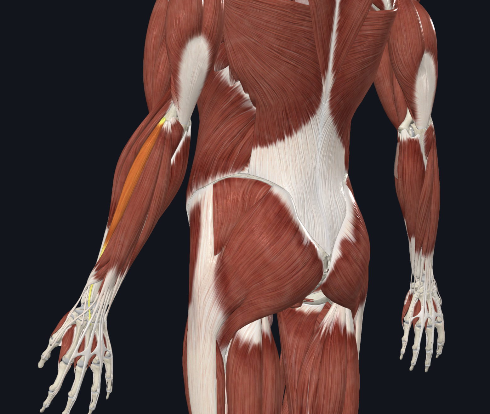 term image