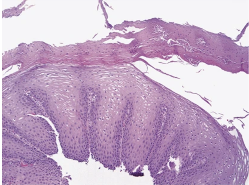 <p>1) diagnostic</p><p>2) histologie</p><p>3) associations causale</p>