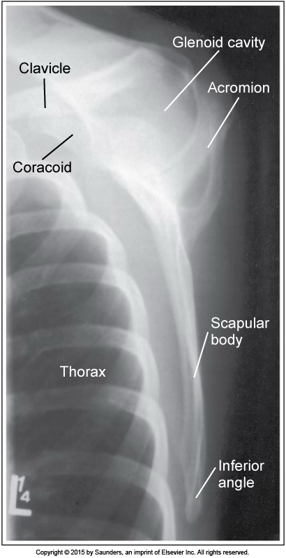 <p>lateral scapula</p>