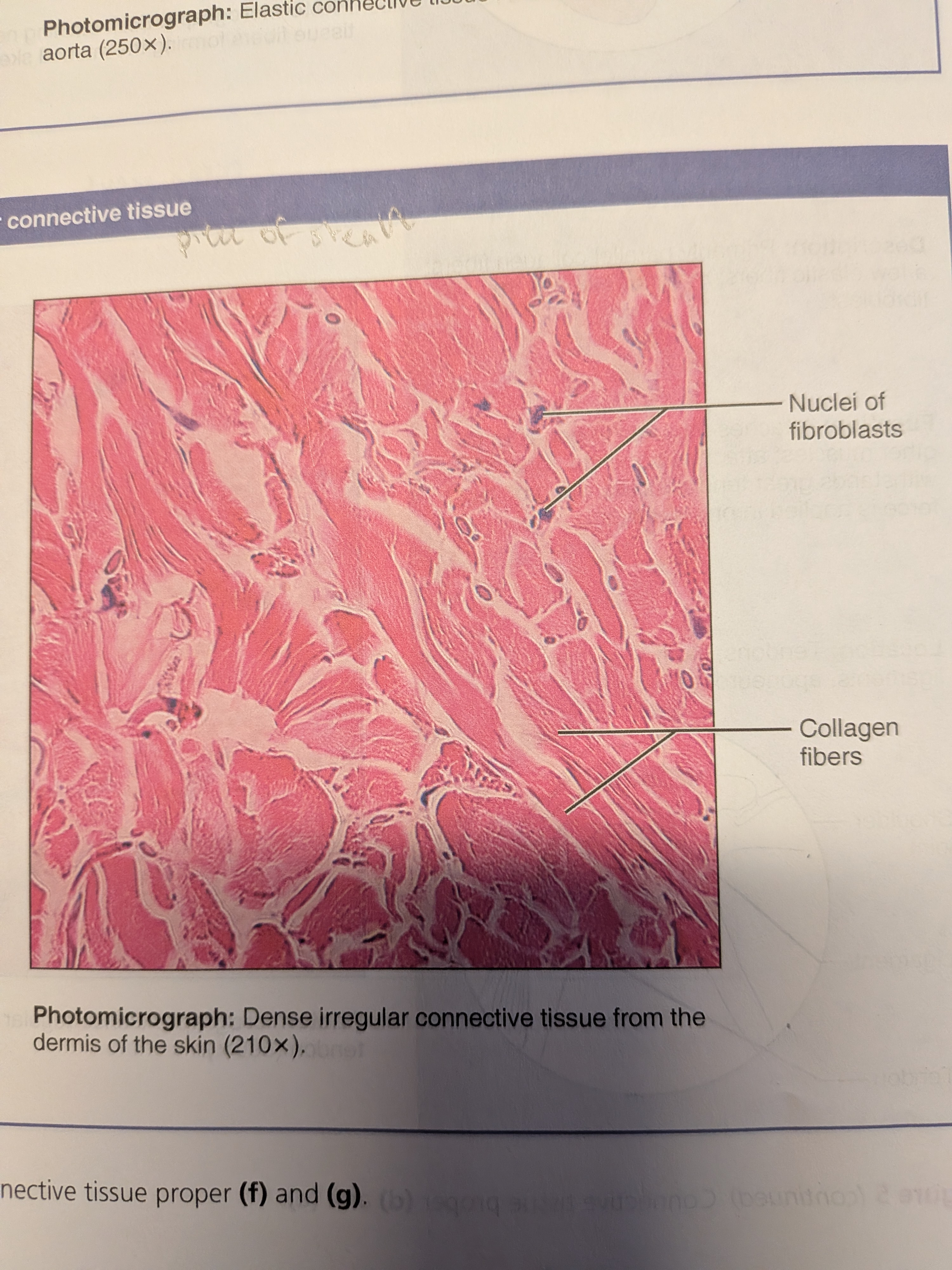 <p>connective tissue proper: dense irregular connective tissue</p>