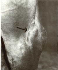 <p>What is the prognosis for tarsal sheath tenosynovitis (thoroughpin)?</p>