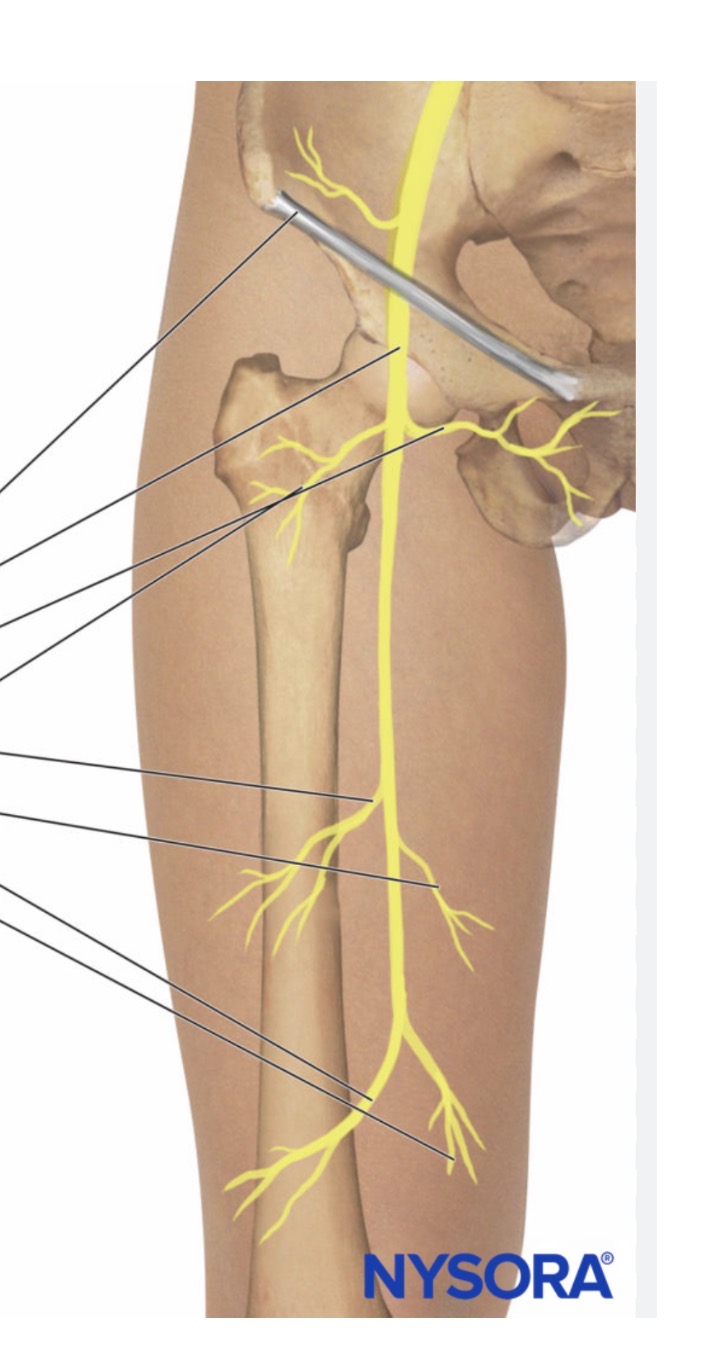<p>the largest nerve of the lumbar plexus, originating from nerve roots L2, L3, and L4, and is responsible for controlling muscles in the front of the thigh and providing sensation to the front of the leg</p>