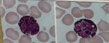 <p>What white blood cell is this</p>