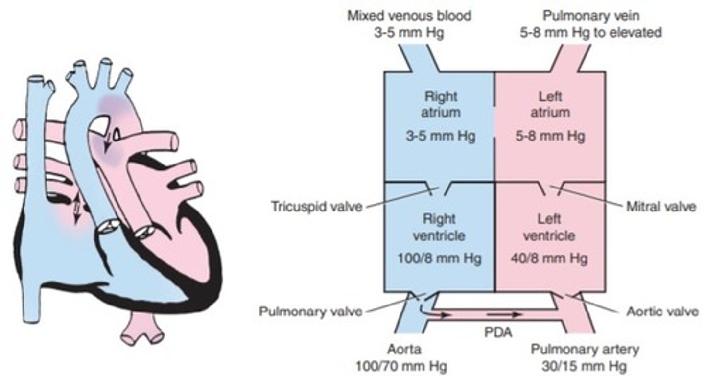 <p>a. coarctation of the aorta</p><p>b. aortic stenosis</p><p>c. transposition of the great arteries</p><p>d. Total anomalous pulmonary venous return</p>