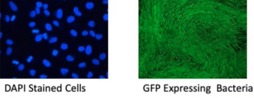 <p><span style="background-color: transparent;"><strong>(DAPI) and Tagged Proteins (GFP)</strong></span></p>