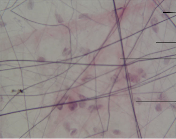 <p>What type of Connective Tissue is shown?</p>