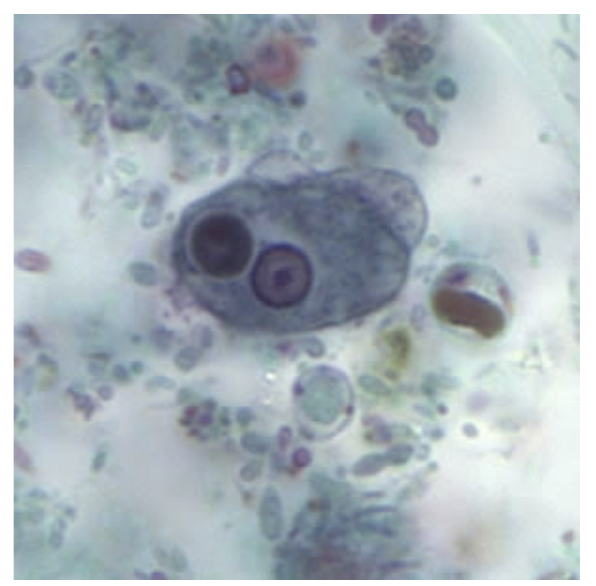 <p>-15--20 microns</p><p>-Small, central karyosome and fine peripheral chromatin</p><p>-May see erythrophagocytosis (diagnostic)</p>