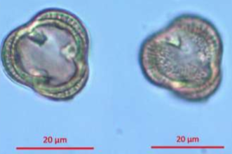 <p>Identify the pollen grains to the <strong>Family</strong> and <strong>Genus</strong></p>