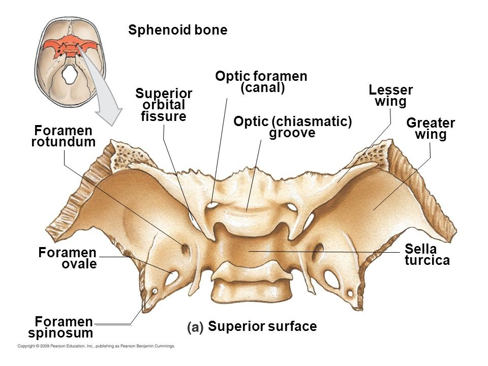 <p>Foramen rotundum</p>