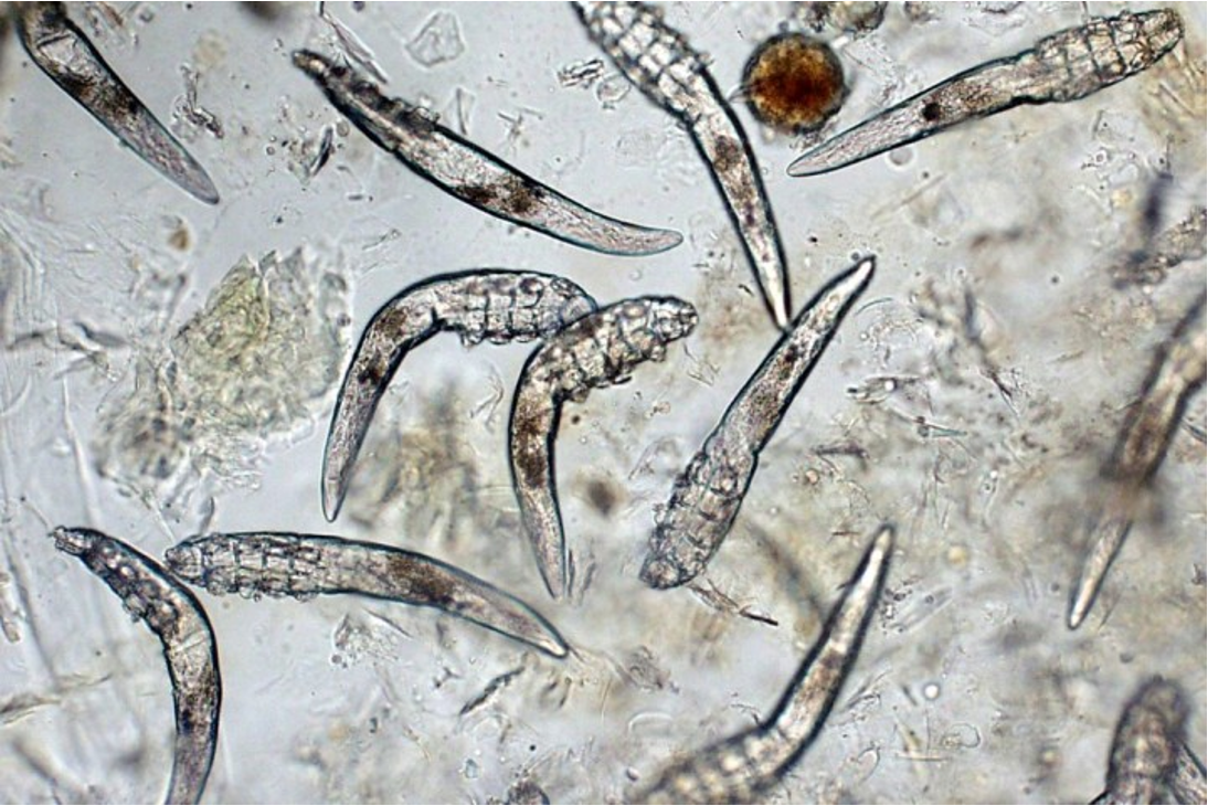 <p>(skin scrappings)</p>