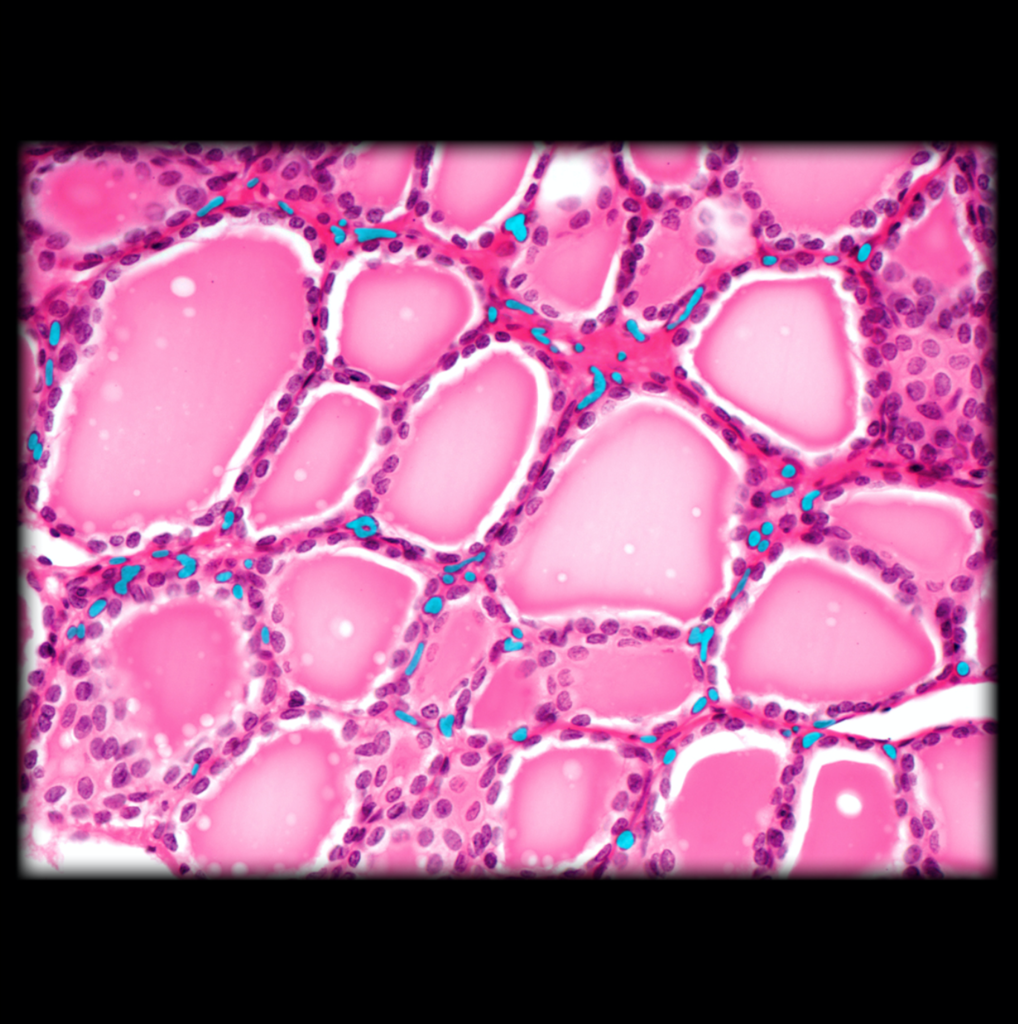 <p>Parafollicular cell of thyroid gland</p>