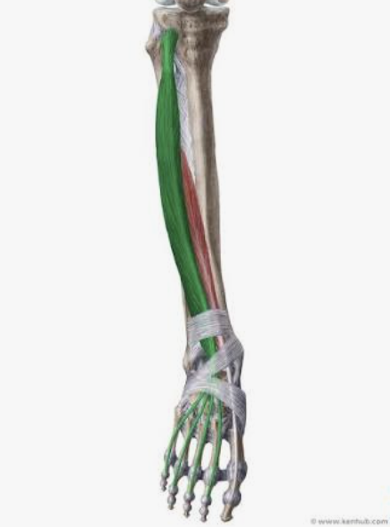 <p>Which muscle is this?</p>