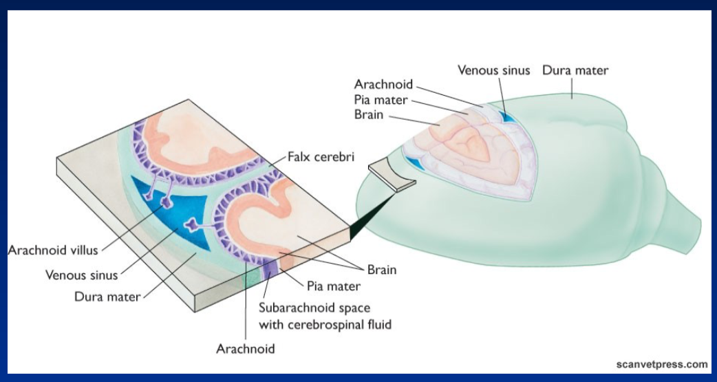 <p><strong>Meninges</strong><br>  • <strong>Dura mater</strong> → outer layer<br>  • <strong>Arachnoid</strong> → middle layer<br>  • <strong>Pia mater</strong> → inner layer, tightly attached to brain tissue</p><p><strong>Structures</strong><br>  • <strong>Venous sinus</strong> → located within the dura mater<br>  • <strong>Falx cerebri</strong> → fold of dura mater between the cerebral hemispheres<br>  • <strong>Arachnoid villus</strong> → projects into the venous sinus<br>  • <strong>Subarachnoid space</strong> → between arachnoid and pia mater<br>    • Contains <strong>cerebrospinal fluid (CSF)</strong><br>  • <strong>Brain</strong> → covered by the pia mater</p>