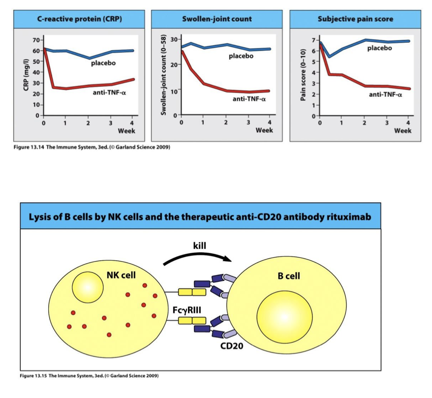<p>Treatment with  (anti) TNFa(alpha) mAb → reduced swelling &amp; pain (top)</p><p></p><p>Treatment with anti CD20 mAb → deplete B cells via ADCC NK(alpha) mAb → reduced swelling &amp; pain (bottom)</p>