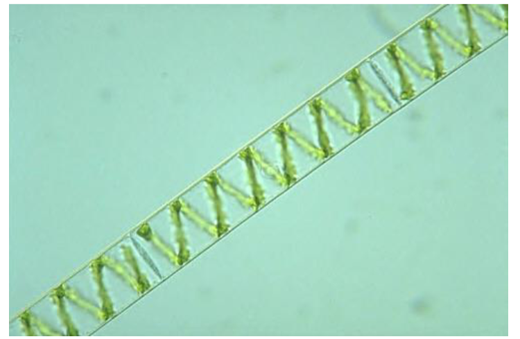 <p>archaeplastida, chlorophyta (green algae)<br>non motile filament; spiral chloroplasts</p>