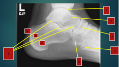 <p>5 (where does it articulate with and what side of the foot is it on)</p>