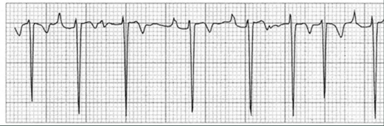 <p>ID this rhythm?</p>