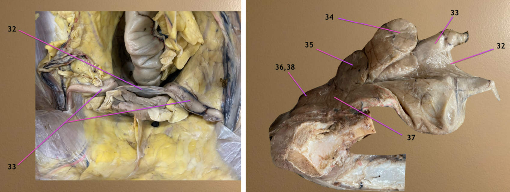 <p>left pic: looking into pelvic cavity, cranial to cd view</p><p>rt pic: looking at ischial arch, cranial to rt</p><p>.</p><p>label 36-38</p><p>38 is covering 36</p>