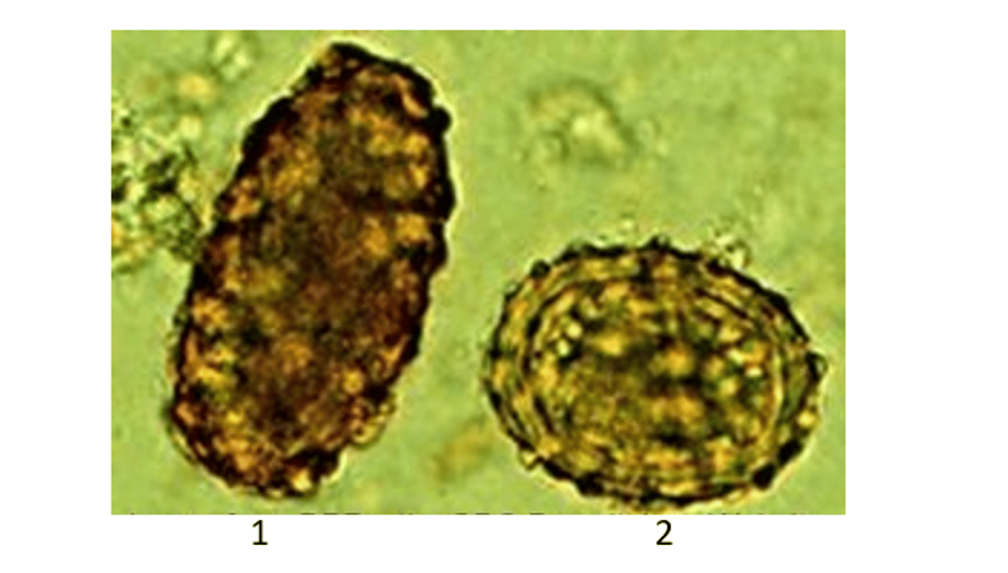 <p>ID who these Nemadote eggs belong to:</p>