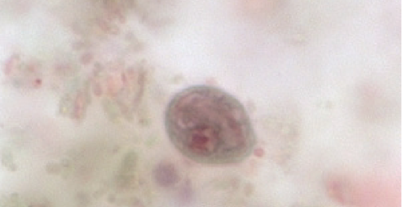 <p>-”Shepard’s crook” cytostome</p>