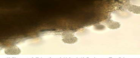 <p>This diesease is known for its hay stack appearance, gram-negative, and primarily affects salmonids</p>