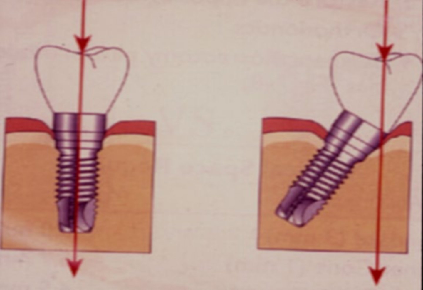 <p>What is the difference for the one on the right?</p>