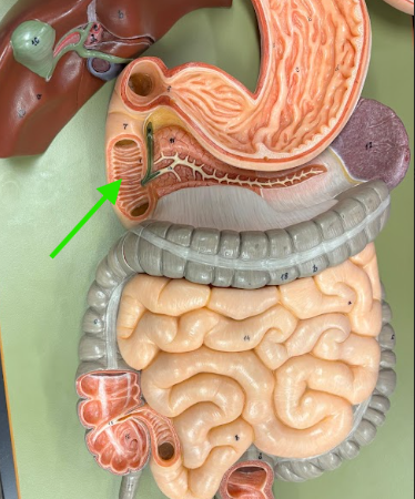 <p>What is the arrow pointing at?</p>