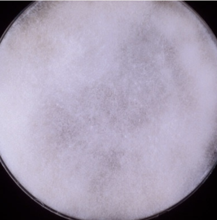 <p>occasional pathogen, pulmonary or disseminated zygomycosis in severely debilitated patients. </p><p>rapid growth, cottony, white to gray surface, pale reverse</p>