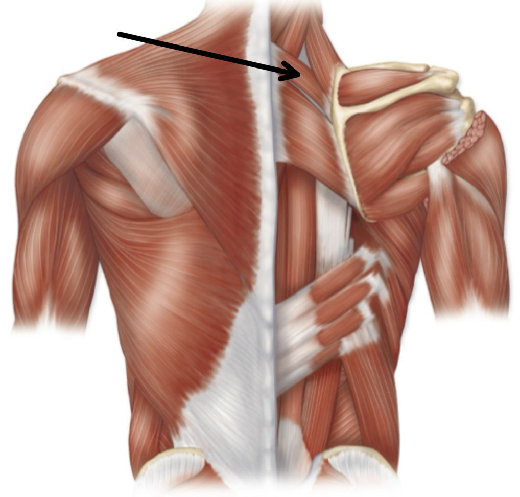term image
