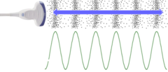 <p>a vibration that transmits energy by alternating regions of high pressure (compression) and low pressure (rarefaction)</p>