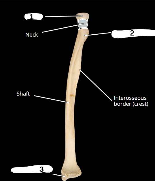 <p>What bone is this?</p>